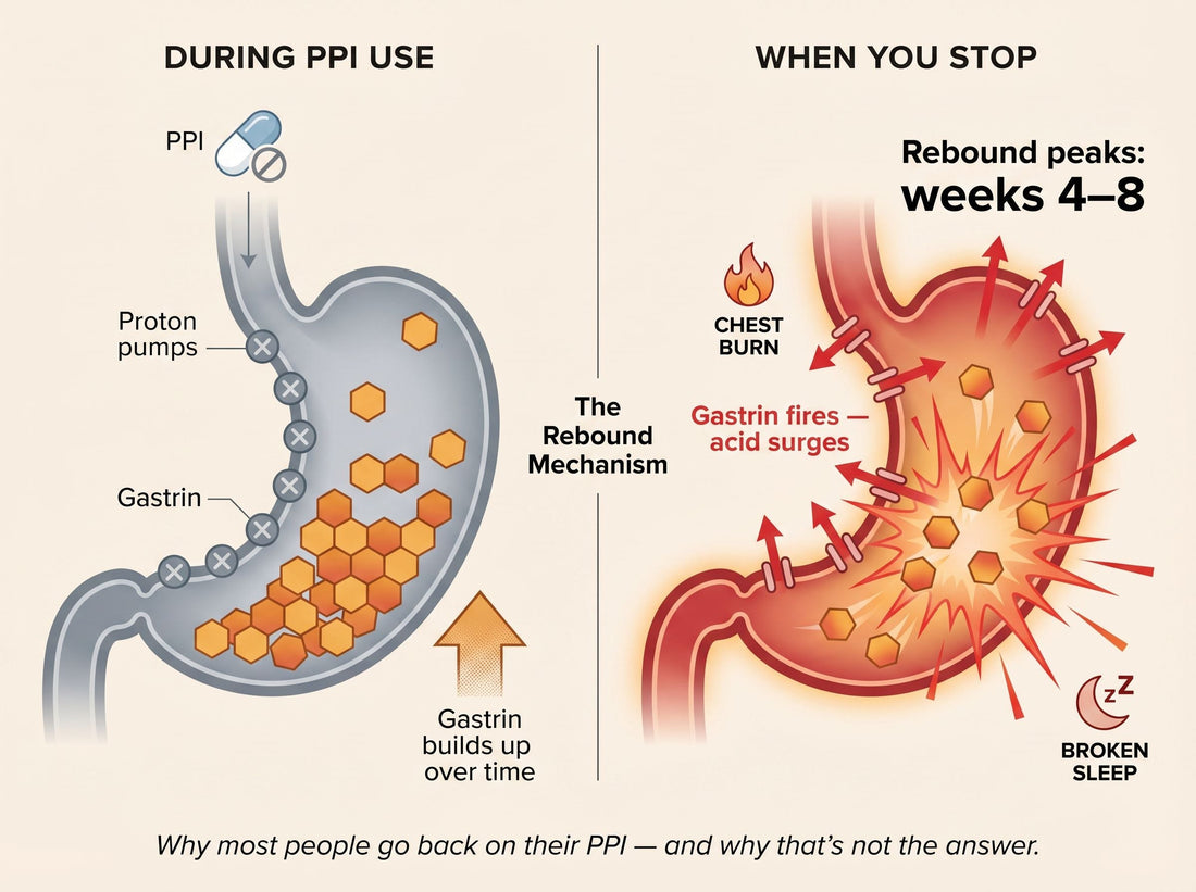 How to Get Off PPIs Safely